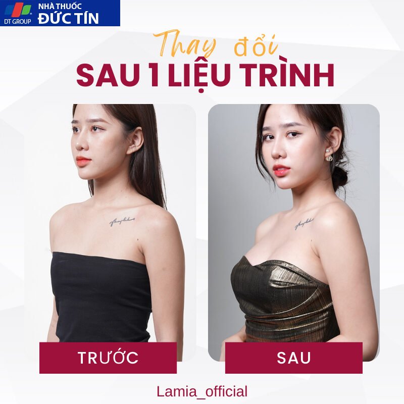 Viên nở ngực LADY PLUS GOLD ( bản cao cấp ) tăng vòng 1 hồng nhũ hoa hiệu quả an toàn hộp 20 viên 18 nonguc5