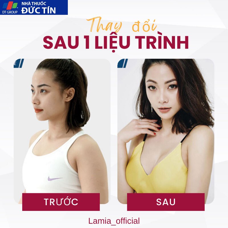 Viên nở ngực LADY PLUS GOLD ( bản cao cấp ) tăng vòng 1 hồng nhũ hoa hiệu quả an toàn hộp 20 viên 17 nonguc6