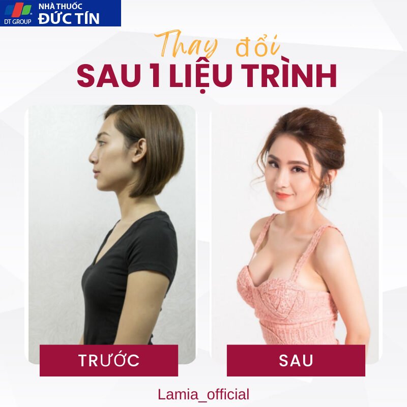 Viên nở ngực LADY PLUS GOLD ( bản cao cấp ) tăng vòng 1 hồng nhũ hoa hiệu quả an toàn hộp 20 viên 16 nonguc7