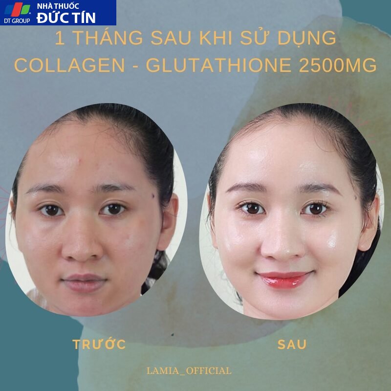 Trắng da COLLAGEN - GLUTATHIONE 2500MG viên uống nâng tone cấp tốc đẹp da giảm nám mờ thâm tức thì 25 trangda4