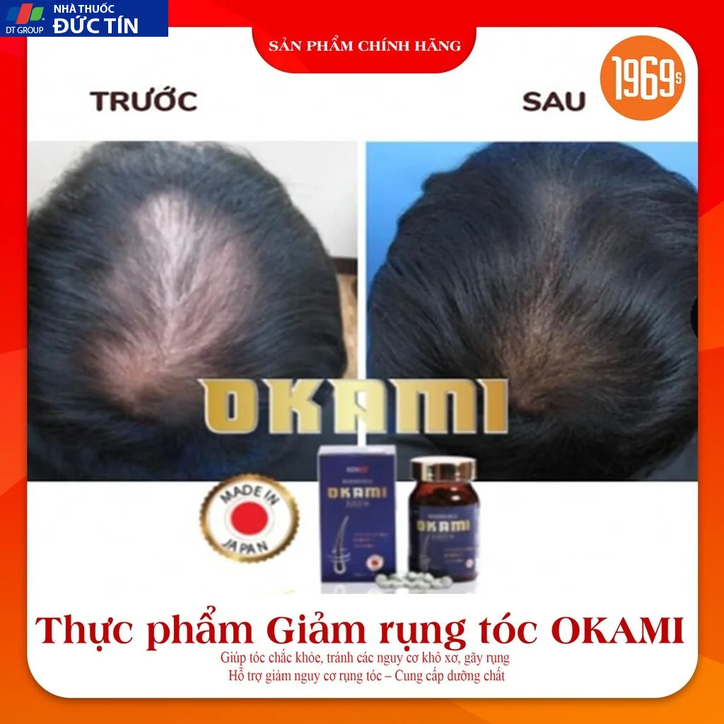 Viên uống hỗ trợ kích mọc tóc OKAMI Nhật Bản ngăn rụng, nuôi dưỡng phục hồi nang tóc khỏe 180 viên 20 moctoc6 1