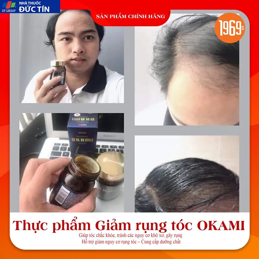 Viên uống hỗ trợ kích mọc tóc OKAMI Nhật Bản ngăn rụng, nuôi dưỡng phục hồi nang tóc khỏe 180 viên 19 moctoc7 2