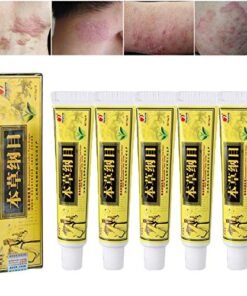 kem bôi nấm ngứa, hắc lào, mề đay, á sừng, viem da, nấm da ông bụt vàng chính hãng 1 tuýp