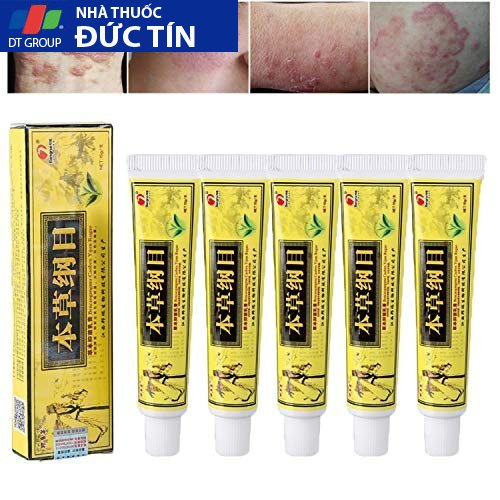 kem bôi nấm ngứa, hắc lào, mề đay, á sừng, viem da, nấm da ông bụt vàng chính hãng 1 tuýp 25 ongbut1