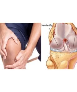 Thuốc bổ hỗ trợ xương và sụn Nuskin Mỹ {Chính hãng} 7 botro2