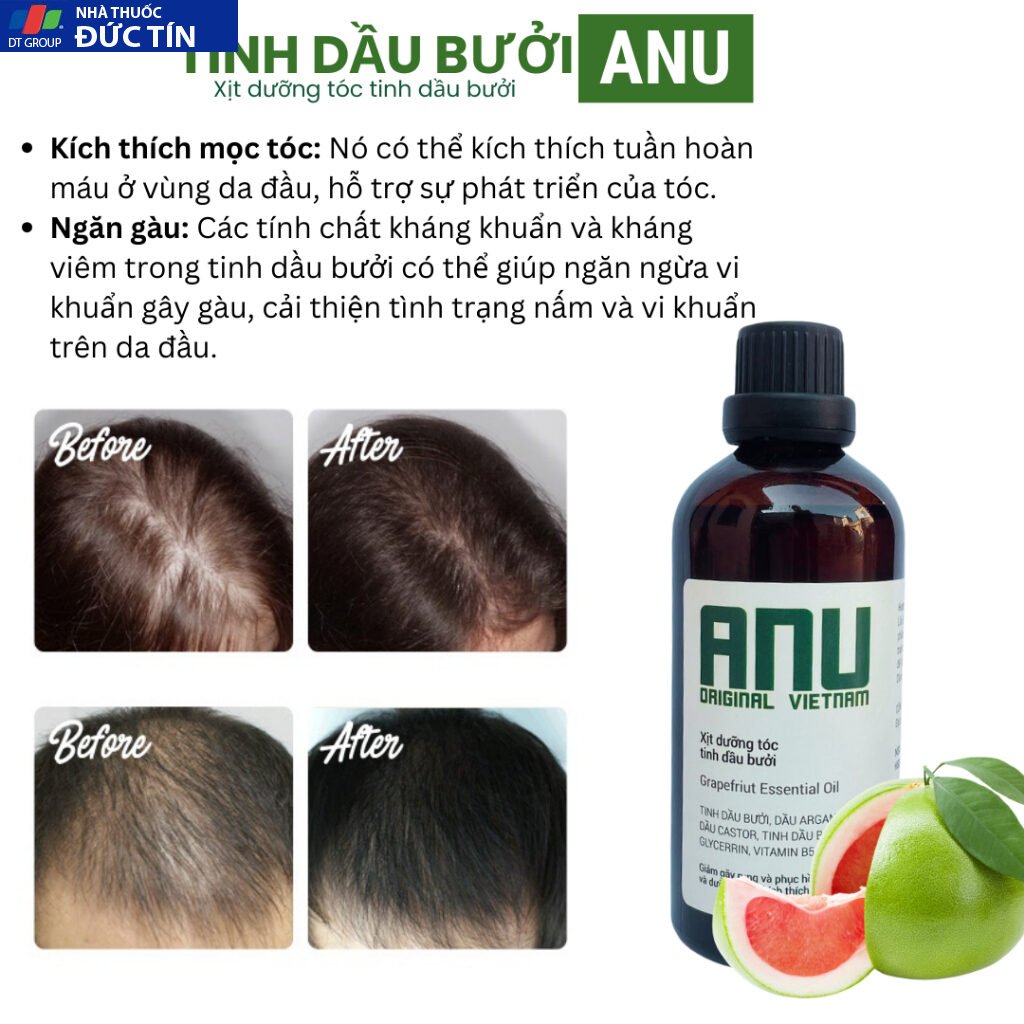 Nước dưỡng tóc tinh dầu bưởi ANU ORIGINAL 100ml giảm rụng phục hồi tóc ngăn hư tổn chẽ ngọn 21 buoi5