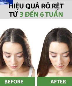 Tinh Dầu Bưởi Ngừa Rụng,Kích Thích Mọc Tóc,Xịt Bưởi Mọc Tóc MILAGANICS 100ml (Chai) 11 buoitinh3