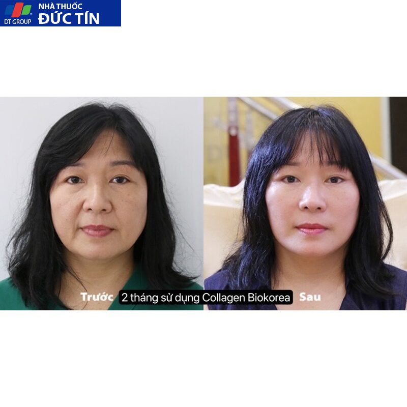 COLLAGEN BIOKOREA nước uống sáng đẹp da, giảm nám tàn nhang, chống lão hoá nâng tone da 15 colagen5 1