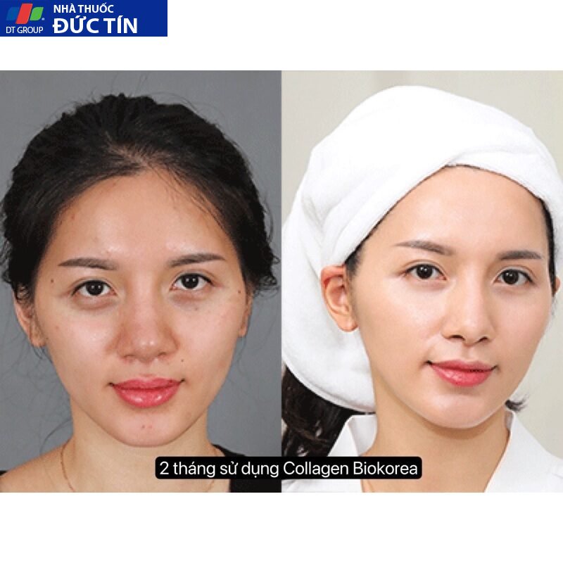 COLLAGEN BIOKOREA nước uống sáng đẹp da, giảm nám tàn nhang, chống lão hoá nâng tone da 14 colagen6 1