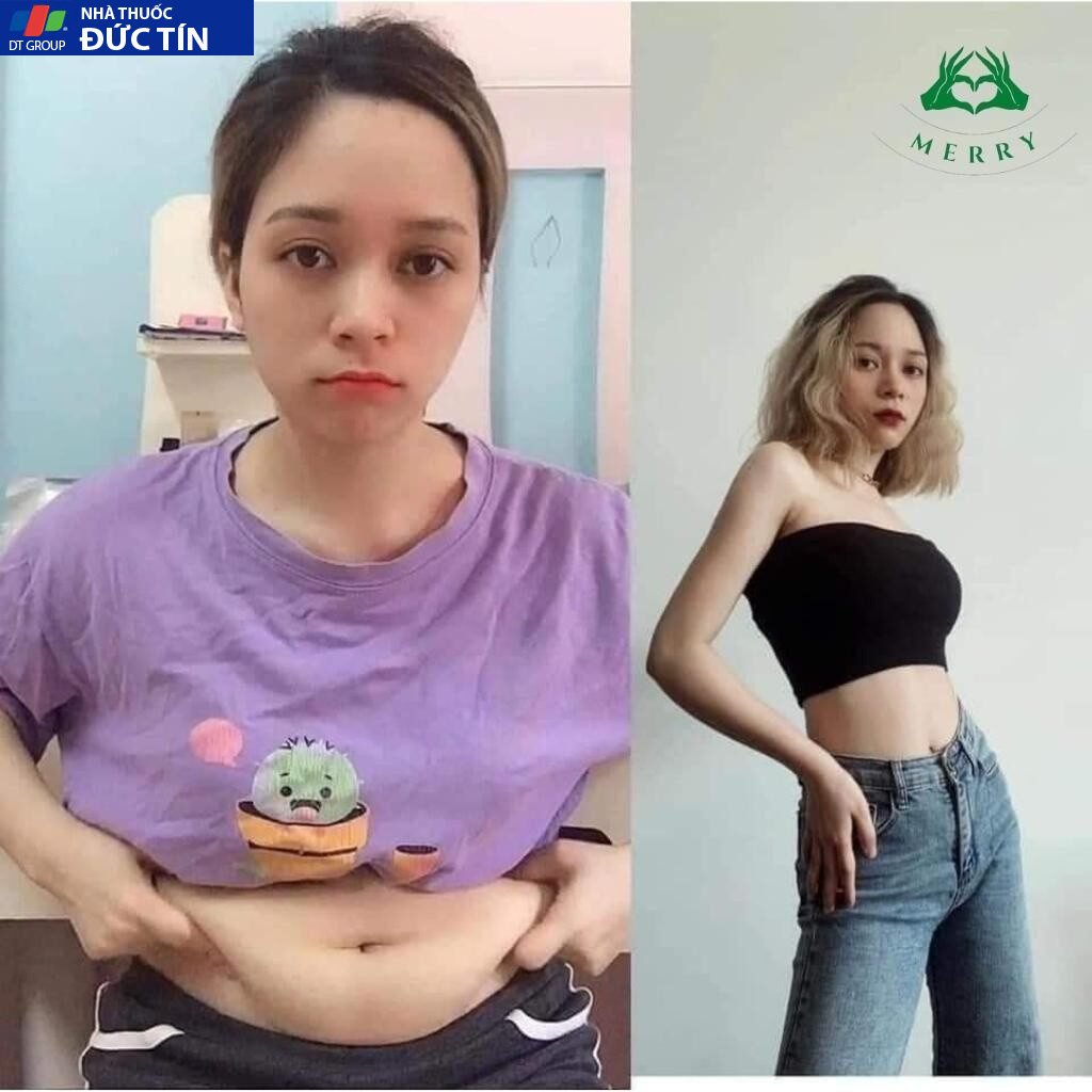 Giảm Cân SLIM BE của BEALIVE Chính Hãng MERRY STORE SLimBe Giúp Giảm Cân An Toàn Giảm 2 đến 3 Kg Sau 15 Ngày 23 giamcan7 2