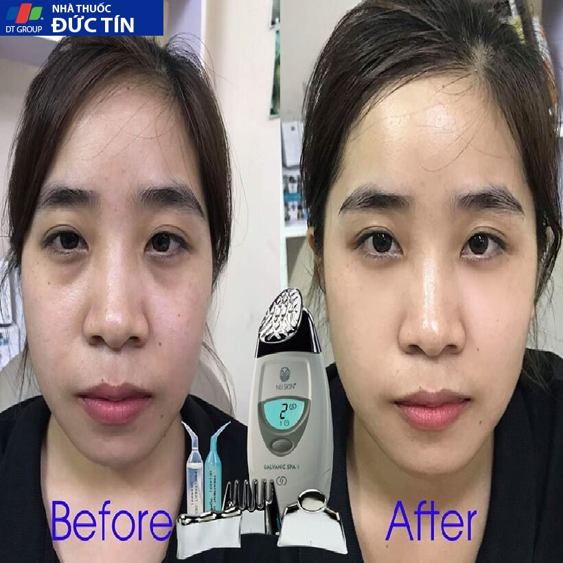{Chính hãng, date mới nhất công ty}Bộ Máy Nâng Cơ Xóa Nhăn Chống Lão Hóa Nuskin Ageloc Galvanic Spa trẻ hóa làn da xử lý 24 maynangco5