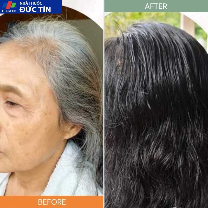 DẦU GỘI PHỦ BẠC LACO ORGANIC NANO NHANH HIỆU QUẢ CHỈ SAU 9 PHÚT KHÔNG LOANG KHÔNG RÁT DA ĐẦU 19 phubac4 1