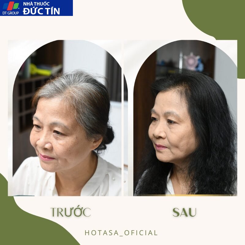 DẦU GỘI PHỦ BẠC LACO ORGANIC NANO CHÍNH HÃNG, THẢO DƯỢC NHUỘM ĐEN TÓC sau 9 PHÚT 25 phubac4