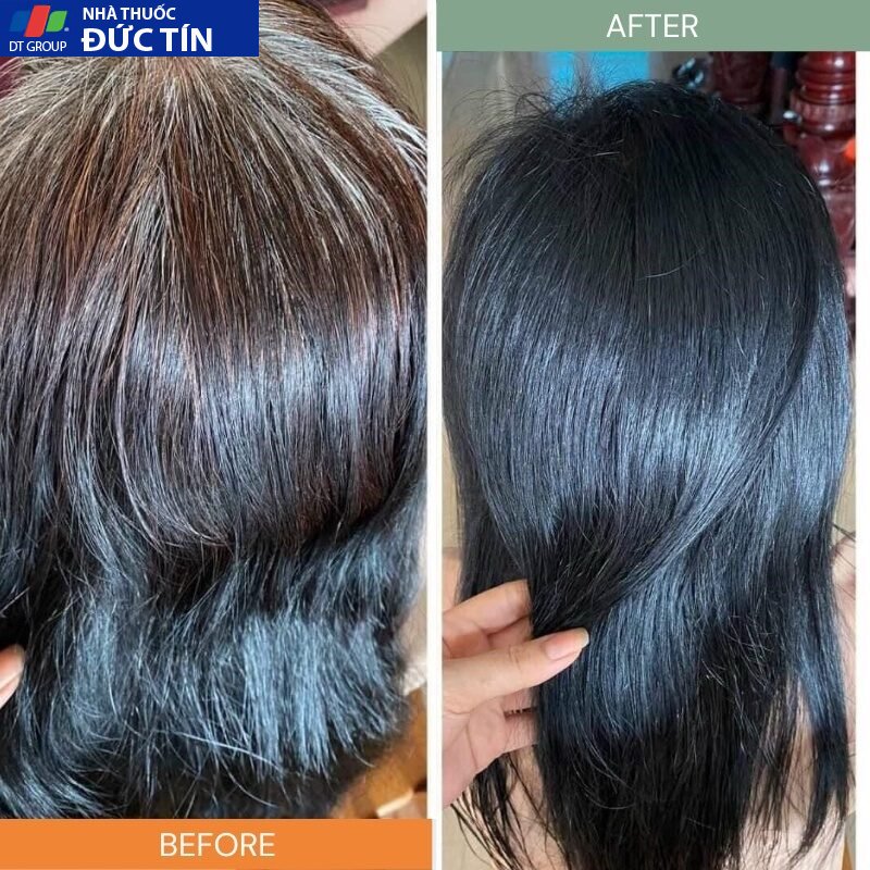 DẦU GỘI PHỦ BẠC LACO ORGANIC NANO NHANH HIỆU QUẢ CHỈ SAU 9 PHÚT KHÔNG LOANG KHÔNG RÁT DA ĐẦU 17 phubac6 1