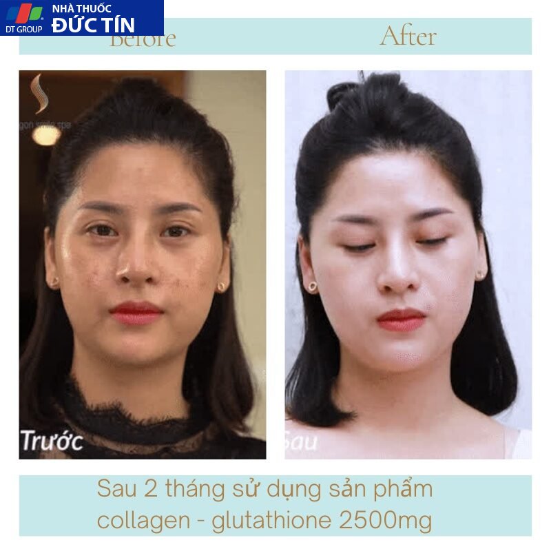 Viên uống trắng da COLAGEN -GLUTATHIONE 2500MG viên uống nâng tone cấp tốc đẹp da giảm nám tàn nhang tăng nội tiết 24 trangda4 5