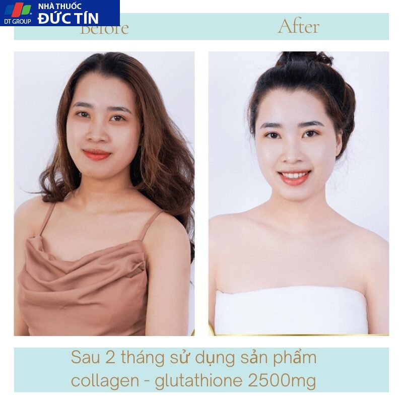 Viên uống trắng da COLAGEN -GLUTATHIONE 2500MG viên uống nâng tone cấp tốc đẹp da giảm nám tàn nhang tăng nội tiết 23 trangda5 4
