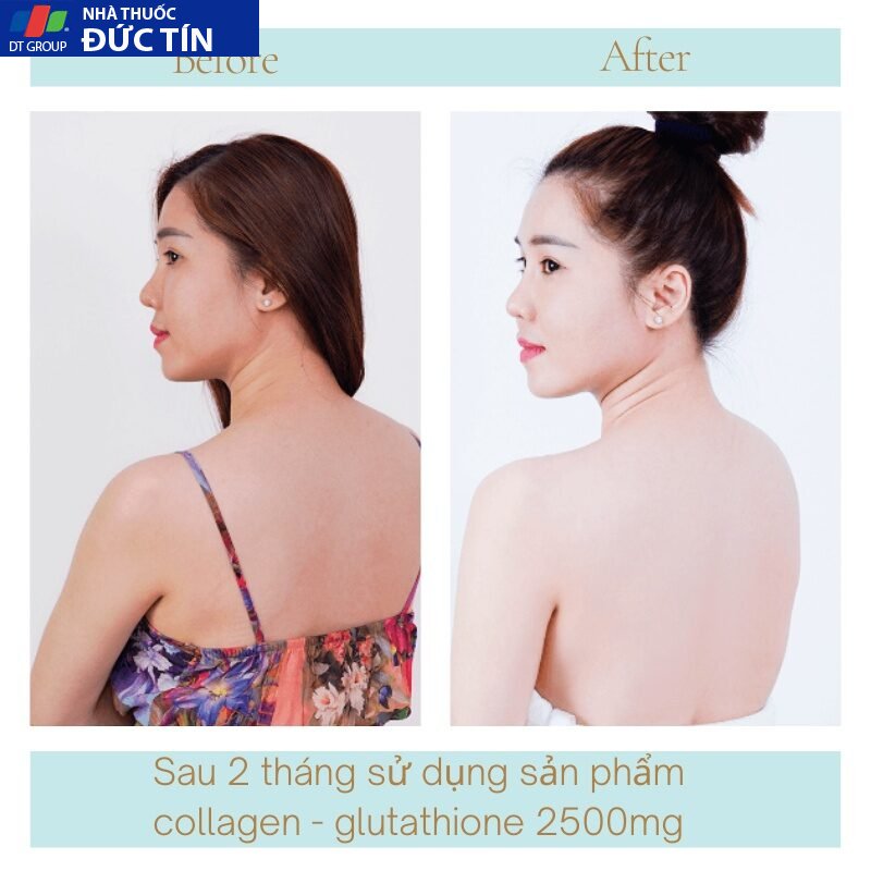 Viên uống trắng da COLAGEN -GLUTATHIONE 2500MG viên uống nâng tone cấp tốc đẹp da giảm nám tàn nhang tăng nội tiết 22 trangda6 3