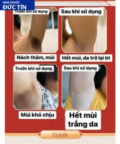 Xịt Khử Mùi Hôi Nách Hữu Cơ Khử Mùi Cơ Thể Khử Mùi Hôi Nách Chính Hãng Guangyao Baiyunshan 9 hoichan4