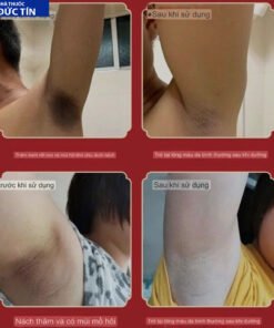 Xịt Khử Mùi Hôi Nách Hữu Cơ Khử Mùi Cơ Thể Chính Hãng Guangyao Baiyunshan 23 hoinach8 2