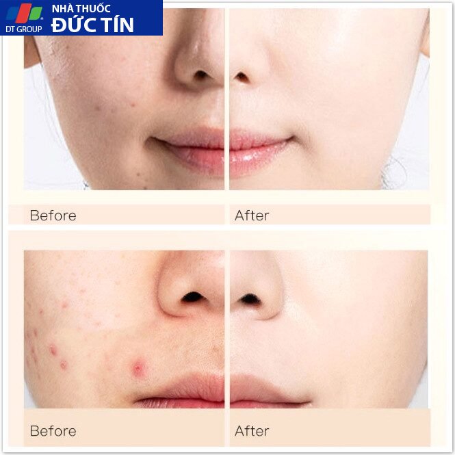Kem Nền Che Khuyết Điểm Nude Air QUYÊN LARA Làm Trắng Da,Thu Nhỏ Lỗ Chân Lông,Phù Hợp Cho Da Dầu 50ml 23 kemnen6