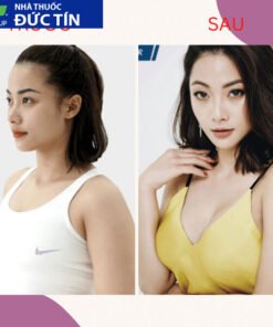 Viên sủi nở ngực LADY PLUS GOLD săn chắc tăng size vòng 1, hồng nhũ hoa hiệu quả tức thì hộp 30 viên 14 nonguc4