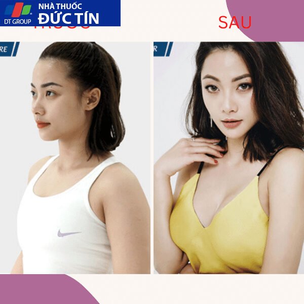 Viên sủi nở ngực LADY PLUS GOLD săn chắc tăng size vòng 1, hồng nhũ hoa hiệu quả tức thì hộp 30 viên 25 nonguc4