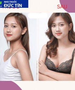 Viên sủi nở ngực LADY PLUS GOLD săn chắc tăng size vòng 1, hồng nhũ hoa hiệu quả tức thì hộp 30 viên 15 nonguc5