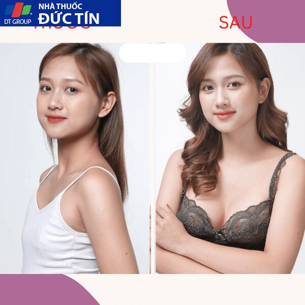 Viên sủi nở ngực LADY PLUS GOLD săn chắc tăng size vòng 1, hồng nhũ hoa hiệu quả tức thì hộp 30 viên 24 nonguc5