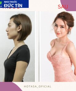 Viên sủi nở ngực LADY PLUS GOLD săn chắc tăng size vòng 1, hồng nhũ hoa hiệu quả tức thì hộp 30 viên 16 nonguc6