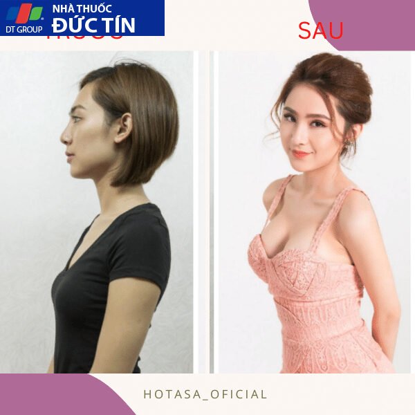 Viên sủi nở ngực LADY PLUS GOLD săn chắc tăng size vòng 1, hồng nhũ hoa hiệu quả tức thì hộp 30 viên 23 nonguc6