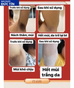 Xịt Khử Mùi Hôi Nách Hữu Cơ Khử Mùi Cơ Thể Chính Hãng Guangyao Baiyunshan 27 vanson3