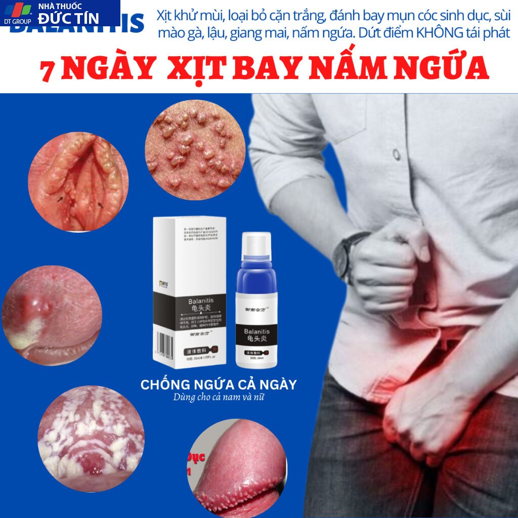 Xịt balanitis giúp hỗ trợ loại bỏ sùi mào gà, hạt ngọc dv, gai sinh dục nhanh chóng sau 1 tuần sử dụng 9 (che tên ) 21 balan1 1