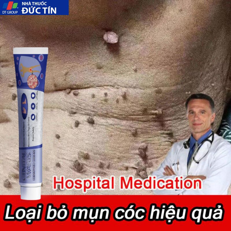 Kem trị mụn cóc,mụn thịt bộ phận sinh dục hiệu quả,loại bỏ mụn cóc thông thường, mụn cơm phẳng Mụn cóc dạng sợi và acumi 28 ekmmo1 1