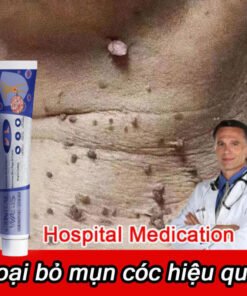 Kem trị mụn cóc,mụn thịt bộ phận sinh dục hiệu quả,loại bỏ mụn cóc thông thường, mụn cơm phẳng Mụn cóc dạng sợi và acumi