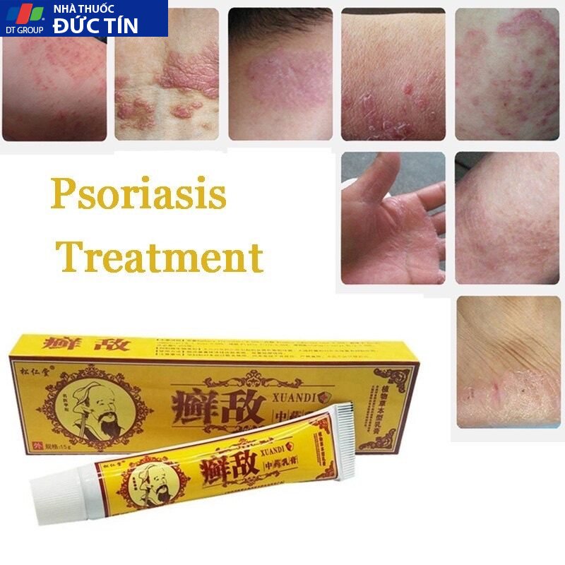 kem bôi, ngoài da, hỗ trợ,nấm ngứa, chàm,tổ đỉa,ghẻ nước,hắc lào ,lăng ben,viêm, loại mới,chính hãng,nội địa TQ 13 gel1