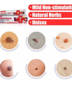 Kem South Moon bôi Nấm Ngứa, Sùi Mào Gà, Mụn Cóc, Mụn Cơm Vùng Kín Nam Nữ, hết ngứa ngay lập tức 9 kemmo4