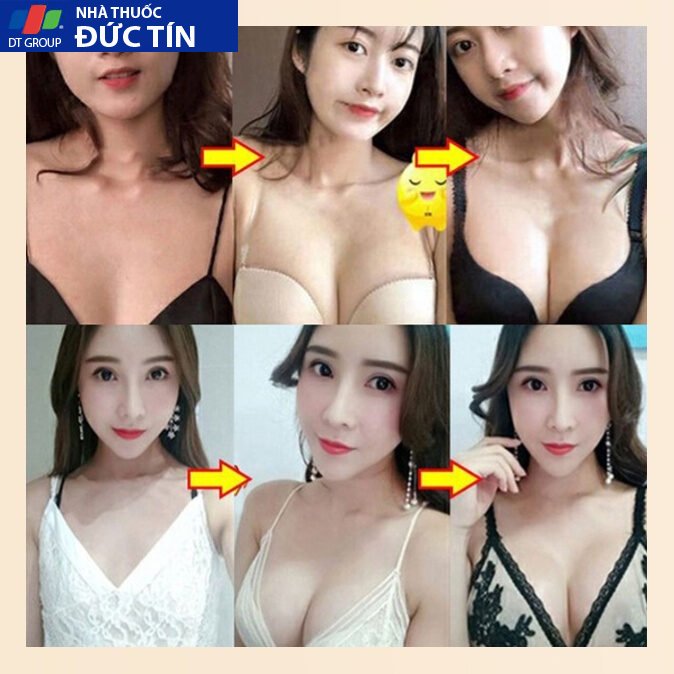 Kem nở ngực 100gkích thích phát triển tăng vòng size hiệu quả chống lại tình trạng ngực chảy xệ giúp Ngực trắng và mềm 23 kemno6
