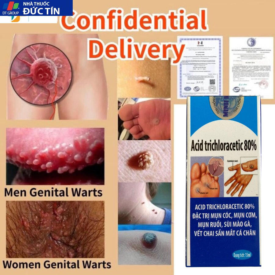 Loại Bỏ Mụn Cơm, Mụn Cóc, Sùi Mào Gà, Mắt Cá Chân, Vết Chai Sần, Mụn Thịt Hiệu Quả Viện Da Liễu HCM 15ML 14 munco1