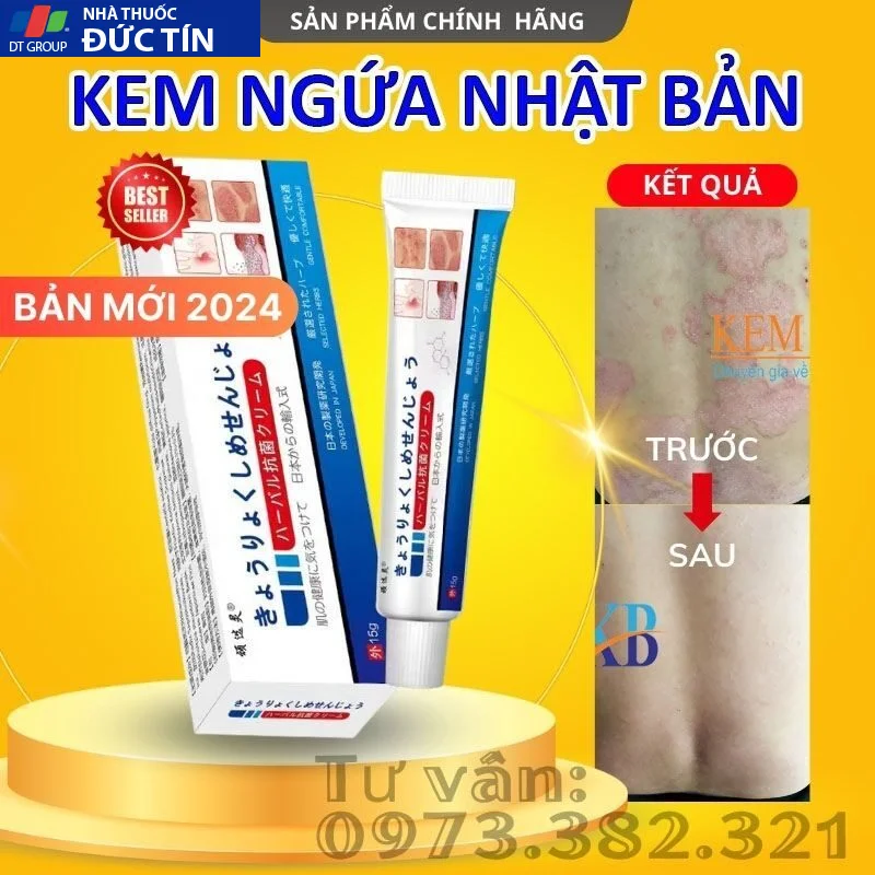 Kem Bôi Viêm Da Cơ Địa NHẬT BẢN Hỗ Trợ Dứt Điểm Lác Đồng Tiền, Nấm Da Đầu, Ghẻ Nước, Á Sừng Cực Kì Hiệu Quả - Ảnh 2