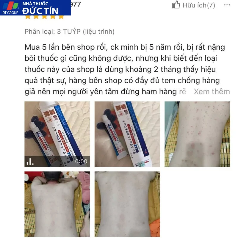 Kem Bôi Viêm Da Cơ Địa NHẬT BẢN Hỗ Trợ Dứt Điểm Lác Đồng Tiền, Nấm Da Đầu, Ghẻ Nước, Á Sừng Cực Kì Hiệu Quả - Ảnh 8