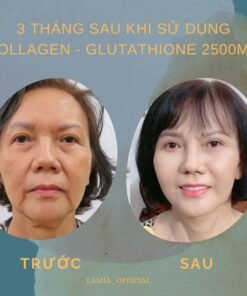 Alternative view of Trắng da COLLAGEN - GLUTATHIONE 2500MG viên uống nâng tone cấp tốc đẹp da giảm nám mờ thâm tức thì