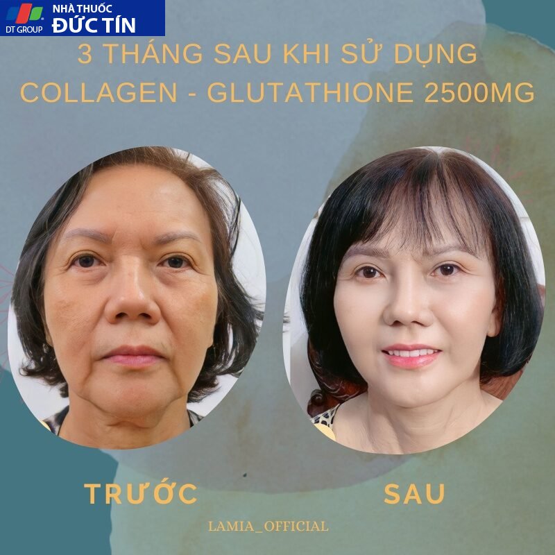 Trắng da COLLAGEN - GLUTATHIONE 2500MG viên uống nâng tone cấp tốc đẹp da giảm nám mờ thâm tức thì 28 rtanda6