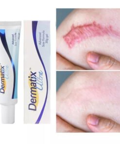 Alternative view of Dermatix Ultra Gel Kem Làm Mờ Sẹo Thâm, sẹo15g [CHÍNH HÃNG]