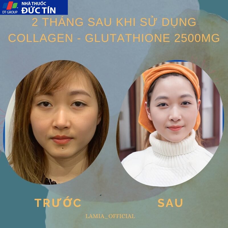 Trắng da COLLAGEN - GLUTATHIONE 2500MG viên uống nâng tone cấp tốc đẹp da giảm nám mờ thâm tức thì 20 trangda5