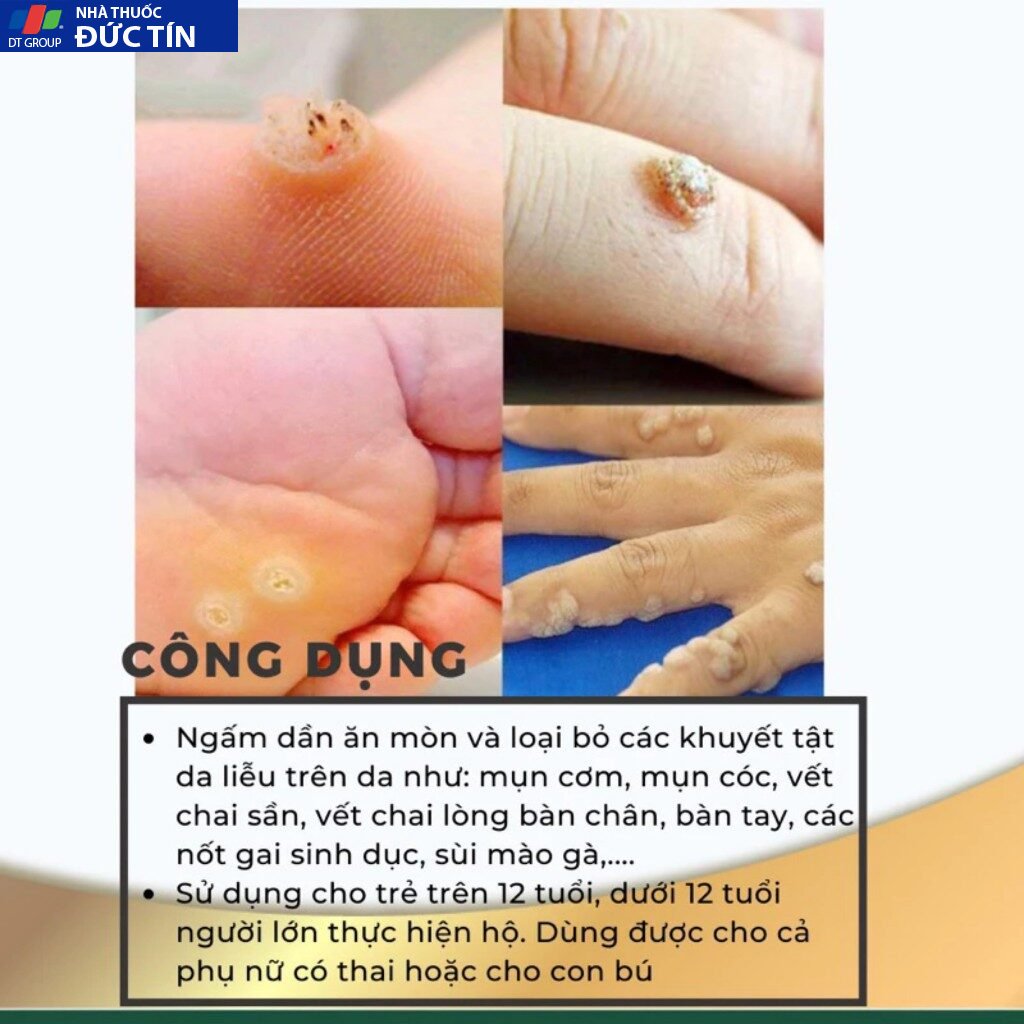 sạch bay mụn cóc,mụn cơm,chai sần lâu năm trong 7 ngày - sản phẩm chính hãng-che tên khi giao 16 duben4