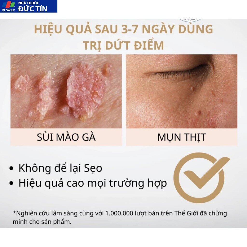 sạch bay mụn cóc,mụn cơm,chai sần lâu năm trong 7 ngày - sản phẩm chính hãng-che tên khi giao 14 duben6