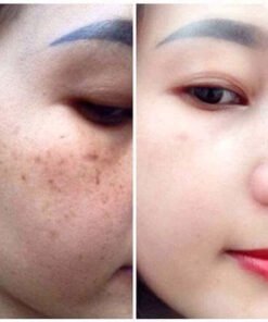 Alternative view of Viên Uống Trắng Da Mờ Nám GLUTATHIONE 2000