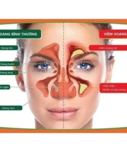 Alternative view of Thổi xoang bt2, 1 lọ thổi mũi bt thành phần tự nhiên không chất bảo quản, có sẵn 1 dây thổi,thổi xoang bt2