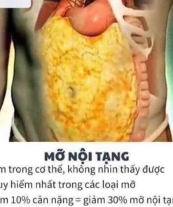 mo noi tang
