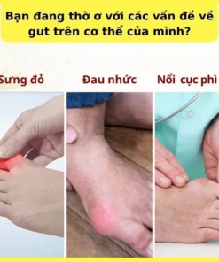 Cao bôi Gout Nhật Bản SENJOKO 50gr - Giảm đau giảm sưng do gút, thẩm thấu sâu vào vùng bị gút, đào thải axit uric 11 caoboi4
